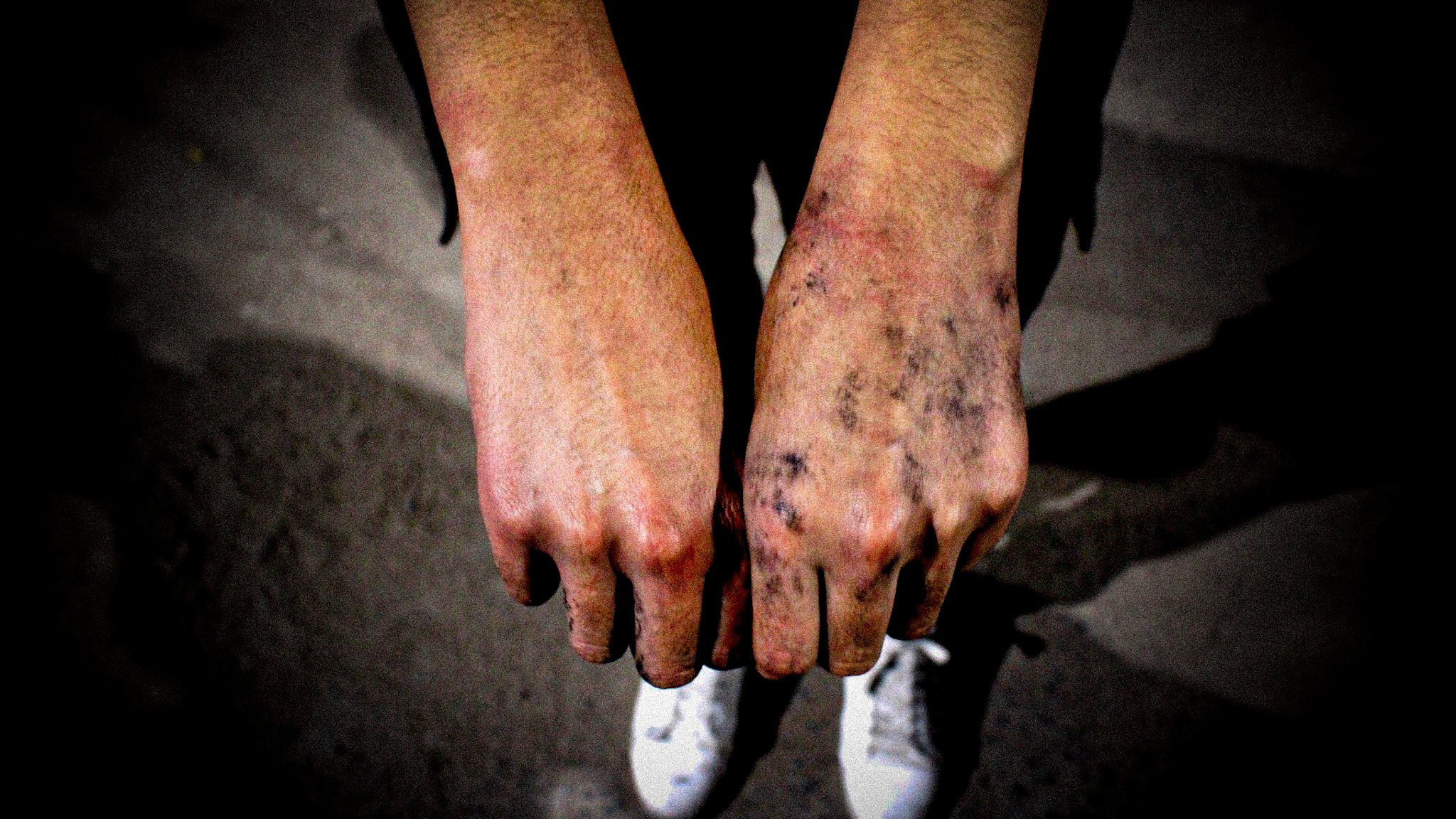  Foto: Alonso Merino Lubetzky 